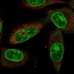 NEK1 Antibody, Novus Biologicals 0.1mL; Unlabeled:Antibodies, Polyclonal